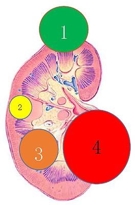 Laparoscopic nephron-sparing surgery for complex renal cystic lesions: a single-center experience